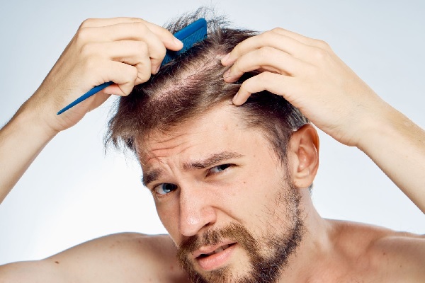 Cách khắc phục tóc xoăn cho nam giới để tạo kiểu dễ dàng hơn